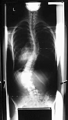 Spine Surgery 2000 Practice Questions: Set 1 (Solved) - Figure 27