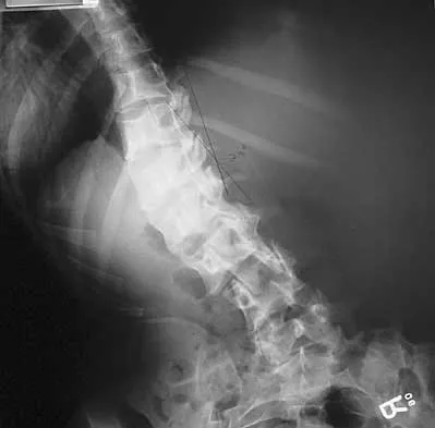 Spine Surgery 2000 Practice Questions: Set 1 (Solved) - Figure 29