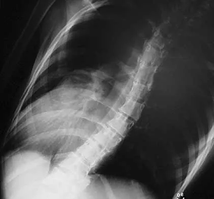 Spine Surgery 2000 Practice Questions: Set 1 (Solved) - Figure 30