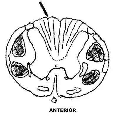 Spine Surgery 2000 Practice Questions: Set 1 (Solved) - Figure 38