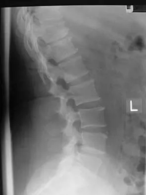 Spine Surgery 2000 Practice Questions: Set 1 (Solved) - Figure 7
