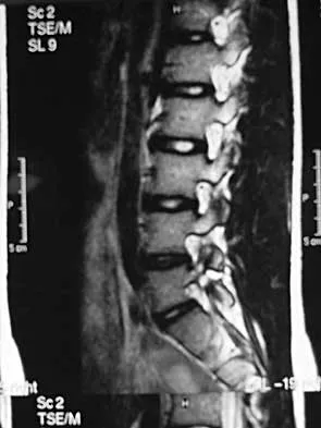 Spine Surgery Board Review 2000: High-Yield MCQs (Set 2) - Figure 12