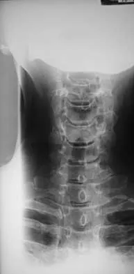 Spine Surgery Board Review 2000: High-Yield MCQs (Set 2) - Figure 16