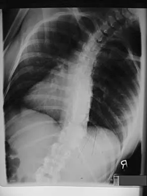 Spine Surgery Board Review 2000: High-Yield MCQs (Set 2) - Figure 19