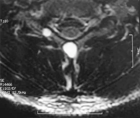 Spine Surgery Board Review 2000: High-Yield MCQs (Set 2) - Figure 26