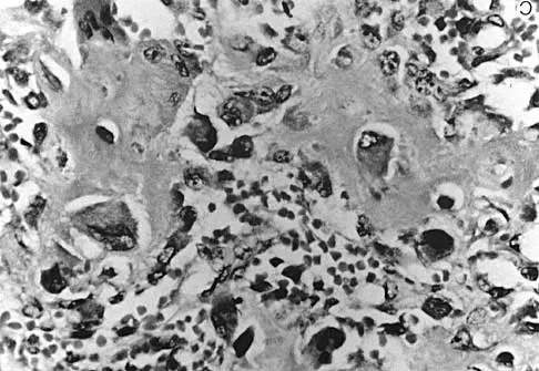 Spine Surgery Board Review 2000: High-Yield MCQs (Set 2) - Figure 27