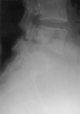 Spine Surgery 2000 Practice Questions: Set 3 (Solved) - Figure 12