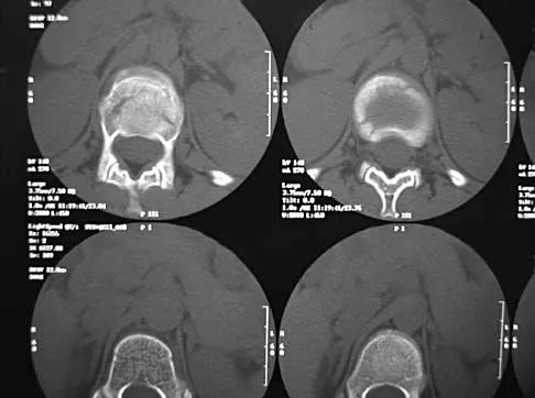 Spine Surgery 2000 Practice Questions: Set 3 (Solved) - Figure 9