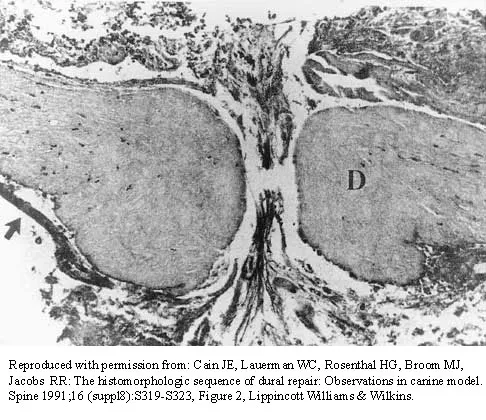Spine Surgery Board Review 2000: High-Yield MCQs (Set 4) - Figure 14