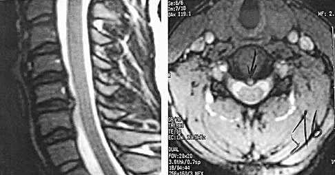 Spine Surgery Board Review 2000: High-Yield MCQs (Set 4) - Figure 8