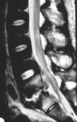 Spine Surgery 2006 Practice Questions: Set 1 (Solved) - Figure 21