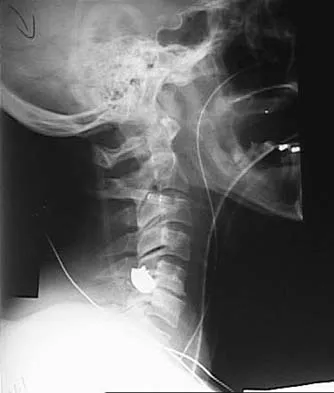 Spine Surgery 2006 Practice Questions: Set 1 (Solved) - Figure 24