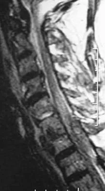 Spine Surgery 2006 Practice Questions: Set 1 (Solved) - Figure 3