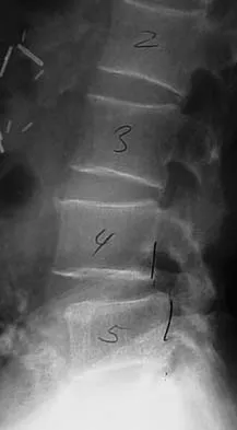 Spine Surgery 2006 Practice Questions: Set 1 (Solved) - Figure 5