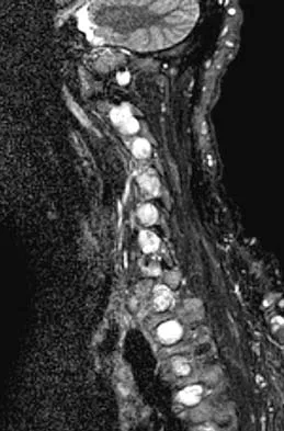Spine Surgery 2006 Practice Questions: Set 1 (Solved) - Figure 7