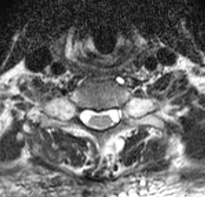 Spine Surgery 2006 Practice Questions: Set 1 (Solved) - Figure 8