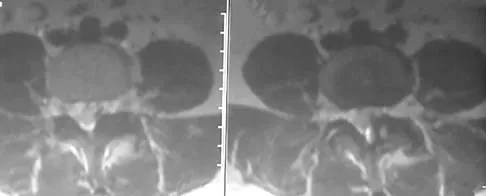 Spine Surgery Board Review 2006: High-Yield MCQs (Set 2) - Figure 10