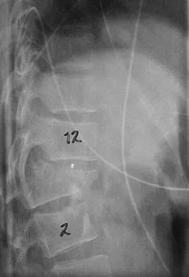 Spine Surgery Board Review 2006: High-Yield MCQs (Set 2) - Figure 2
