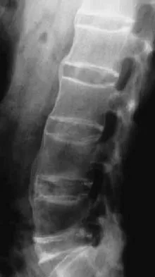 Spine Surgery Board Review 2006: High-Yield MCQs (Set 2) - Figure 4
