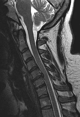 Spine Surgery Board Review 2006: High-Yield MCQs (Set 2) - Figure 5