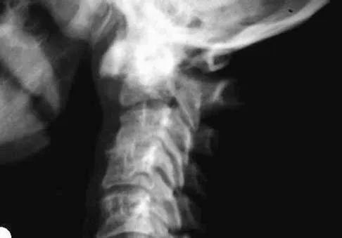 Spine Surgery Board Review 2006: High-Yield MCQs (Set 2) - Figure 8