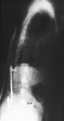 Spine Surgery 2006 Practice Questions: Set 3 (Solved) - Figure 11