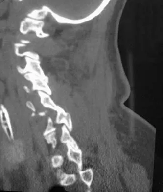 Spine Surgery 2006 Practice Questions: Set 3 (Solved) - Figure 13