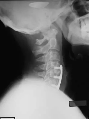 Spine Surgery 2006 Practice Questions: Set 3 (Solved) - Figure 2