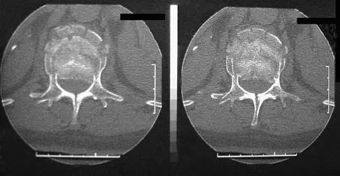 Spine Surgery 2006 Practice Questions: Set 3 (Solved) - Figure 3
