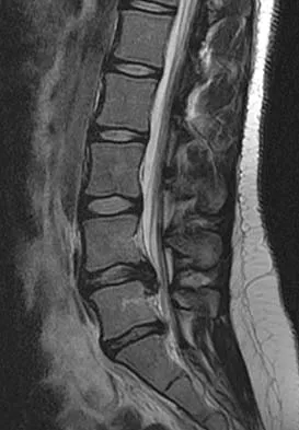 Spine Surgery 2006 Practice Questions: Set 3 (Solved) - Figure 4