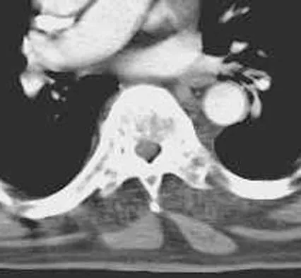 Spine Surgery Board Review 2006: High-Yield MCQs (Set 4) - Figure 11