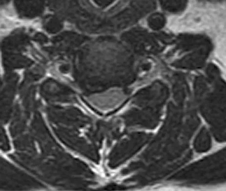 Spine Surgery Board Review 2006: High-Yield MCQs (Set 4) - Figure 13