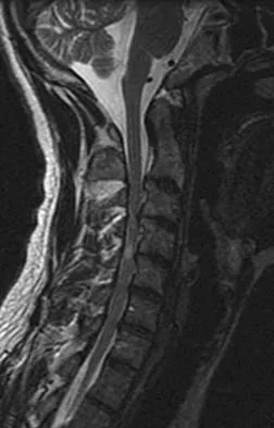 Spine Surgery Board Review 2006: High-Yield MCQs (Set 4) - Figure 2