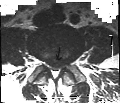 Spine Surgery Board Review 2006: High-Yield MCQs (Set 4) - Figure 9