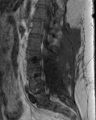 Spine Surgery 2009 Practice Questions: Set 1 (Solved) - Figure 10