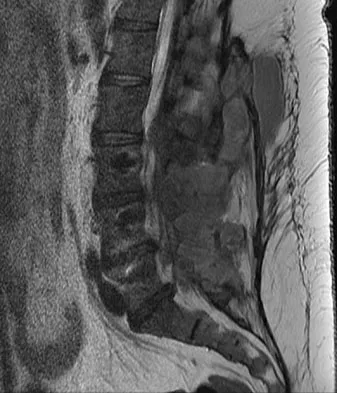 Spine Surgery 2009 Practice Questions: Set 1 (Solved) - Figure 11