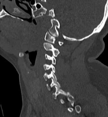 Spine Surgery 2009 Practice Questions: Set 1 (Solved) - Figure 24