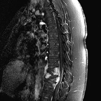Spine Surgery 2009 Practice Questions: Set 1 (Solved) - Figure 29