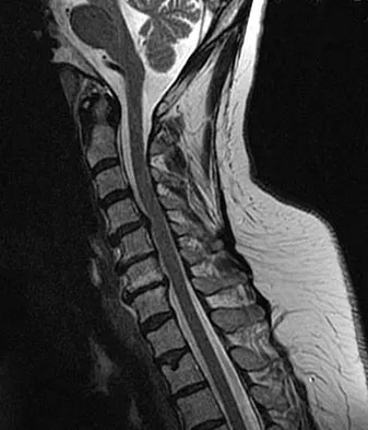 Spine Surgery 2009 Practice Questions: Set 1 (Solved) - Figure 31