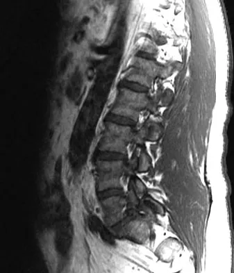 Spine Surgery 2009 Practice Questions: Set 1 (Solved) - Figure 5