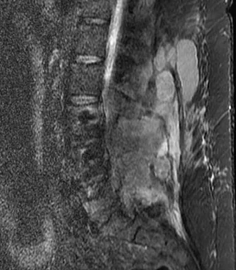 Spine Surgery 2009 Practice Questions: Set 1 (Solved) - Figure 9