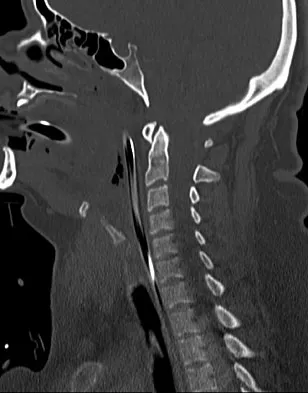 Spine Surgery Board Review 2009: High-Yield MCQs (Set 2) - Figure 15