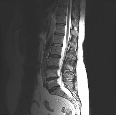 Spine Surgery Board Review 2009: High-Yield MCQs (Set 2) - Figure 16