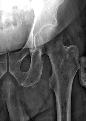 Spine Surgery Board Review 2009: High-Yield MCQs (Set 2) - Figure 19