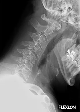 Spine Surgery Board Review 2009: High-Yield MCQs (Set 2) - Figure 2