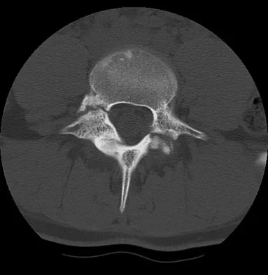 Spine Surgery Board Review 2009: High-Yield MCQs (Set 2) - Figure 26