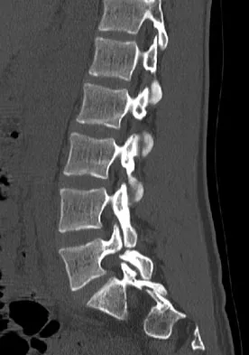 Spine Surgery Board Review 2009: High-Yield MCQs (Set 2) - Figure 27