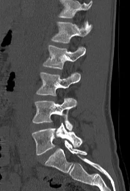 Spine Surgery Board Review 2009: High-Yield MCQs (Set 2) - Figure 28