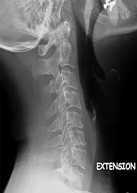 Spine Surgery Board Review 2009: High-Yield MCQs (Set 2) - Figure 3