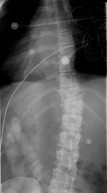 Spine Surgery Board Review 2009: High-Yield MCQs (Set 2) - Figure 8